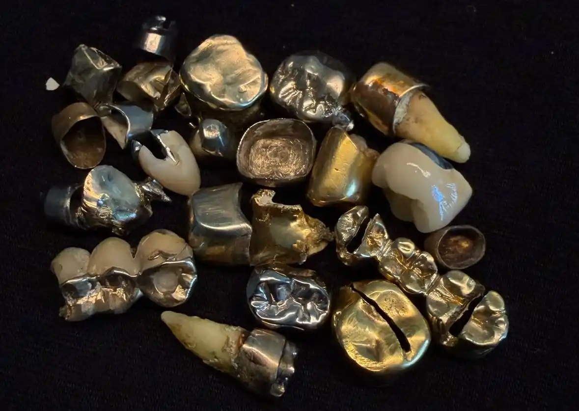 Zahngold